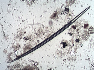 Freshwater Sponge Spicule