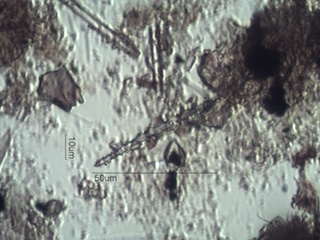 Spongilla lacustris Spicule