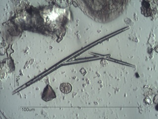 Freshwater Sponge Spicule