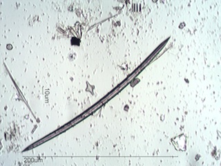 Freshwater Sponge Spicule