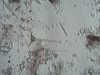 Freshwater Sponge Spicule