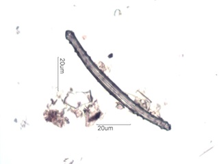 Spongilla lacustris Spicule