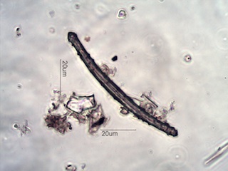 Spongilla lacustris Spicule
