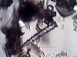 Spongilla lacustris Spicule