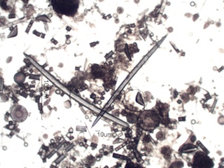 Freshwater Sponge Spicule