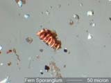 Sporangium Under the Microscope