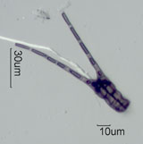 Tetraploa Spore