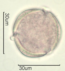Spring Beauty Pollen
