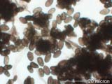 Stachybotrys Spores
