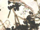 Stachybotrys Standard Atra B