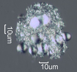 Agglomerated Starch Grains from Food Under the Microscope