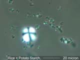 Potato and Rice Starch Under the Microscope