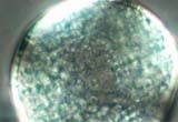Starch Grains in Douglas Fir Pollen