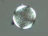Douglas Fir Pollen