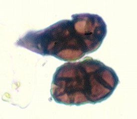 Stemphylium Spores