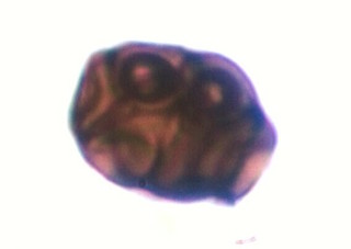 Stemphylium Spores