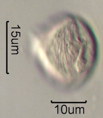 Strawberry (Fragaria x ananassa) Pollen