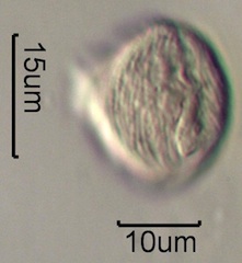 Strawberry (Fragaria x ananassa) Pollen