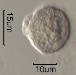 Strawberry (Fragaria x ananassa) Pollen