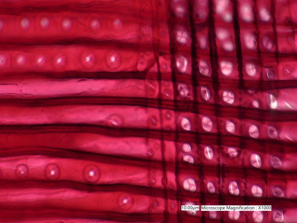 Pinus lambertiana, Radial Section