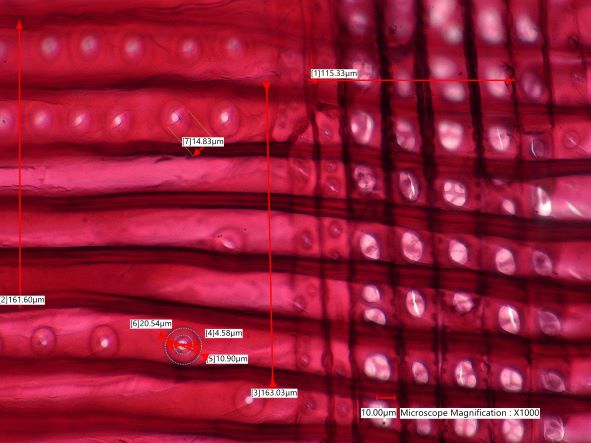 Pinus lambertiana, Radial Section