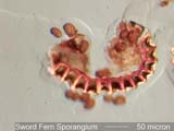 Sword Fern Sporangium Under the Microscope