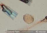 Sword Fern Spores Under the Microscope