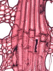 American Sycamore, Cross-Section