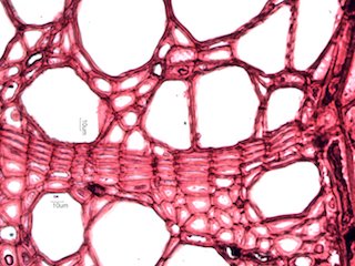 American Sycamore, Cross-Section