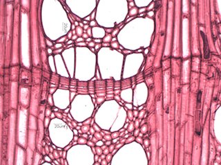 American Sycamore, Cross-Section
