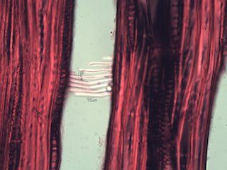 American Sycamore, Radial Section