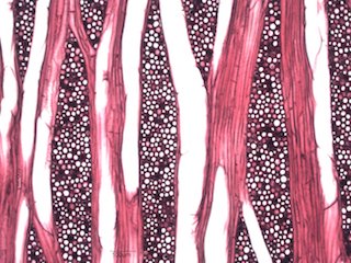 American Sycamore, Tangential Section