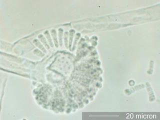 Syncephalastrum Spores