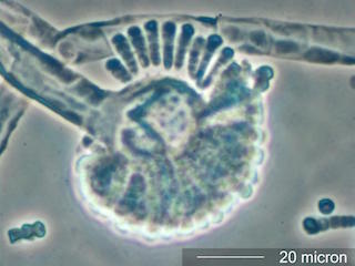 Syncephalastrum Spores