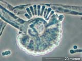 Syncephalastrum Spores