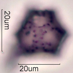 Dandelion (Taraxacum officinale) Pollen
