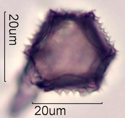 Dandelion (Taraxacum officinale) Pollen