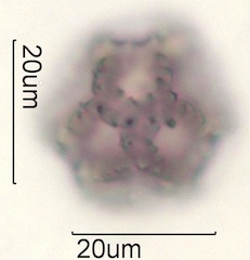 Dandelion (Taraxacum officinale) Pollen