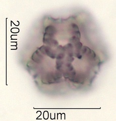 Dandelion (Taraxacum officinale) Pollen