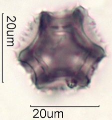 Dandelion (Taraxacum officinale) Pollen