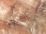 Electro-static Discharge Scar