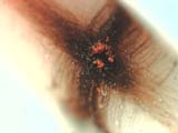Electro-static Discharge Scar