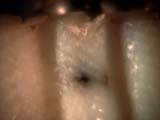 Electro-static Discharge Scar