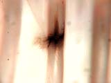 Electro-static Discharge Scar