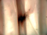 Electro-static Discharge Scar