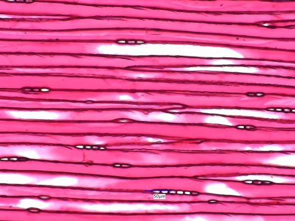 Thuja occidentalis, Tangential Section