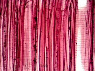Tilia americana Radial Section