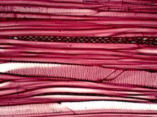 Tilia americana Tangential Section