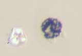 Toner and Starch Grain