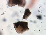 Slag